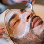 Microdermabrasion