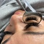 Eyelash Removal