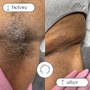 Brazilian wax+ Post wax Vajacial