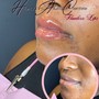 Needle-Less Lip Filler (3 ML)