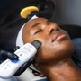 Oxygen Infusion Facial