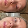 Eyelash Extension Removal