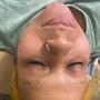 Eyelash Extension Removal