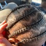 Loc Coils