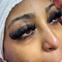 Eyelash Removal