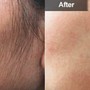 Men’s Brazilian Wax