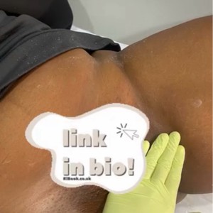Allison King Esthetician photo 3